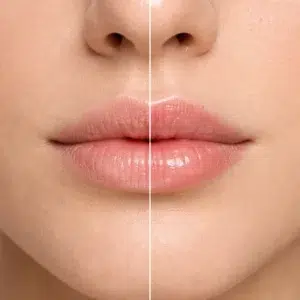 BALSAMO PER LABBRA CHOGAN 1