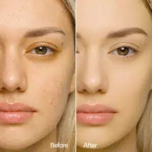 CHOGAN MERINGUE FOUNDATION – LSF 30 SONNENSCHUTZ 1